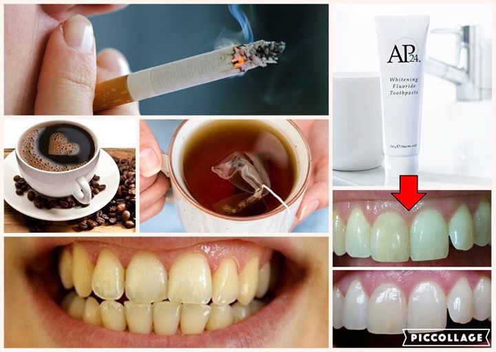 Whitening Toothpaste